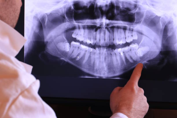 Best Walk-In Emergency Dental Services in Suffern, NY