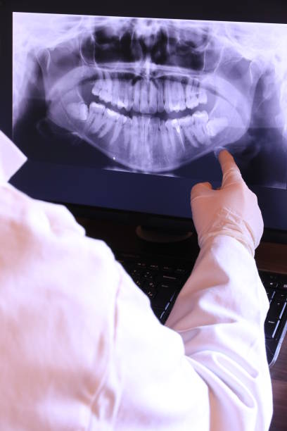 Best Emergency Denture Repair in Suffern, NY